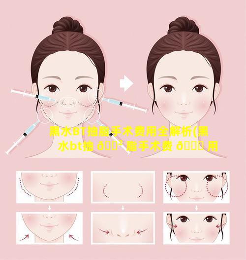 黑水BT抽脂手术费用全解析(黑水bt抽 🌲 脂手术费 🐟 用全解析)